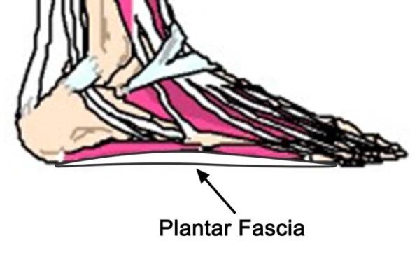 C:UsersuserDesktopPTAG Foot and Ankle coursePTAG Course imagesplantar fascia.jpg